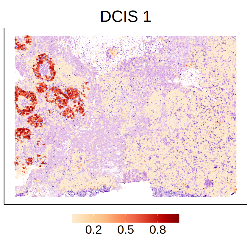 ../../_images/analysis_breast_cancer_breast_cancer_seg_method_comparison_MCube_39_0.png