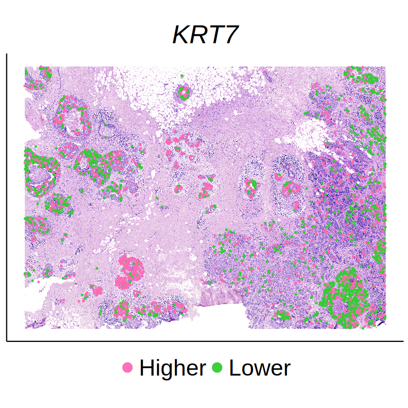 ../../_images/analysis_breast_cancer_breast_cancer_seg_method_comparison_MCube_46_0.png